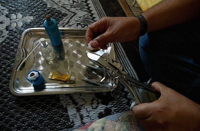 Male Circumcision