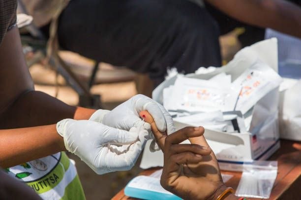Complicated Malaria Guide